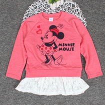 Outer size baby clothes girl Autumn Spring dress sweater hair ring Korean version of Tide big childrens dress little girl Day single