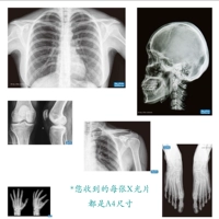 6 рентгеновские снимки тела человеческого тела A4
