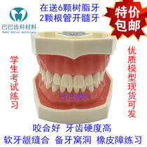 Dental preparation model Send 6 teeth Examination practice Preparation of fossa inlay crown Removable tooth gingival discharge