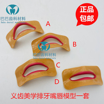 Dental denture material false lip control mold Denture dental control mold set of 4
