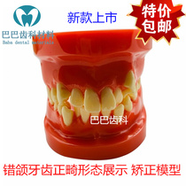 Orthodontic model practice orthodontic model oral model dentist practice wrong jaw tooth model