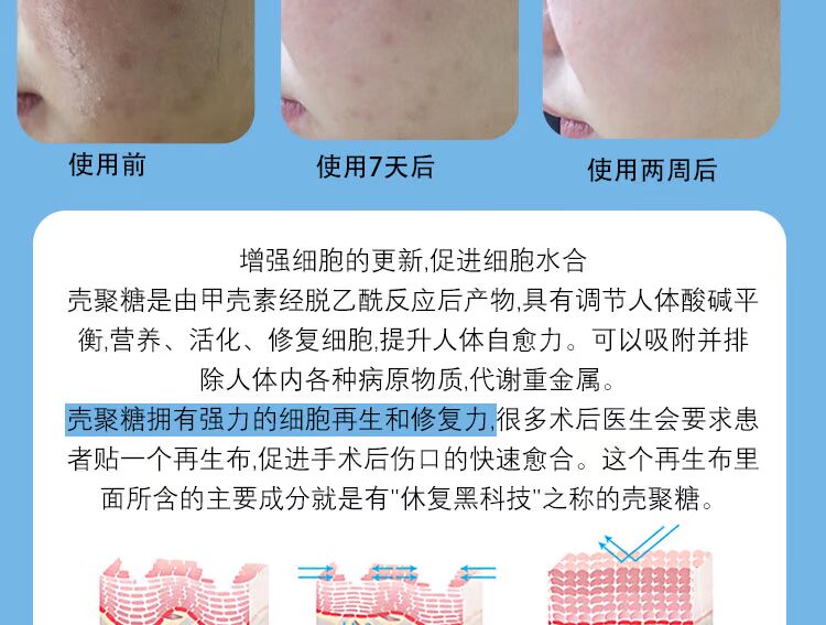 Hàn Quốc Ai bác sĩ sửa chữa băng nhỏ 95% thành phần chitosan sơ cứu mặt nạ dưỡng ẩm Dr.Althea 14 - Mặt nạ mặt nạ môi bioaqua