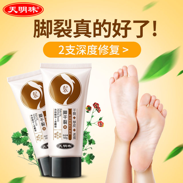 Tianmingzhu ຄີມຕີນສໍາລັບຕີນແຕກ, ຫນ້າກາກຕີນເພື່ອເອົາຜິວຫນັງທີ່ຕາຍແລ້ວ, calluses, heels, ມືແລະຕີນ, ປ້ອງກັນຮອຍແຕກ, Fei Ma Oil Cream