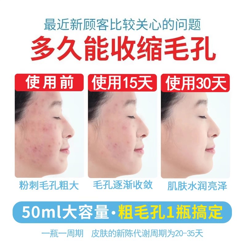 Thu nhỏ lỗ chân lông tinh chất sửa chữa lỗ chân lông lớn nam và nữ se khít lỗ chân lông thu nhỏ dưỡng ẩm serum ahc màu đỏ