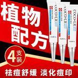 Acne acne pit repair cream desalination anti-inflammatory acne acne products male and female artifact red swollen aloe gel