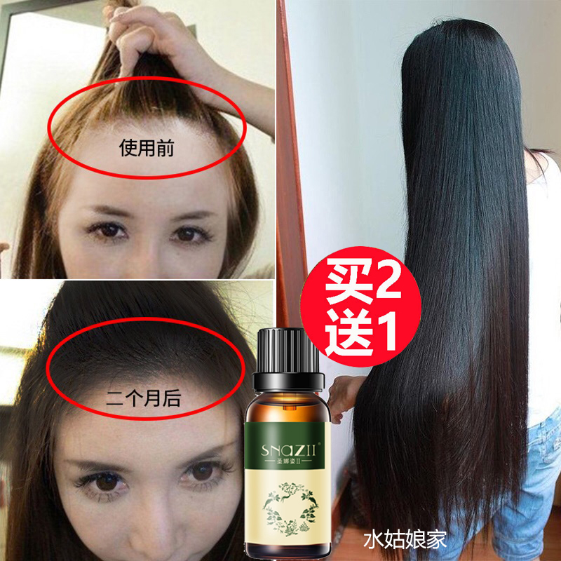 Usd 47 43 Hair Growth Fluid Fast Short Hair Long Hair Growth
