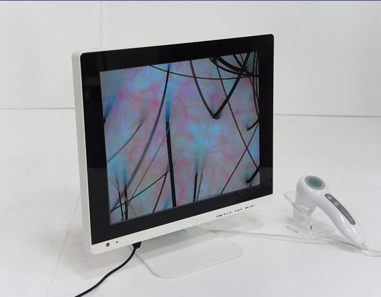 Three-spectral head HD scalp detection instrument hair follicle detection scope comparison of hair follicle beauty salon