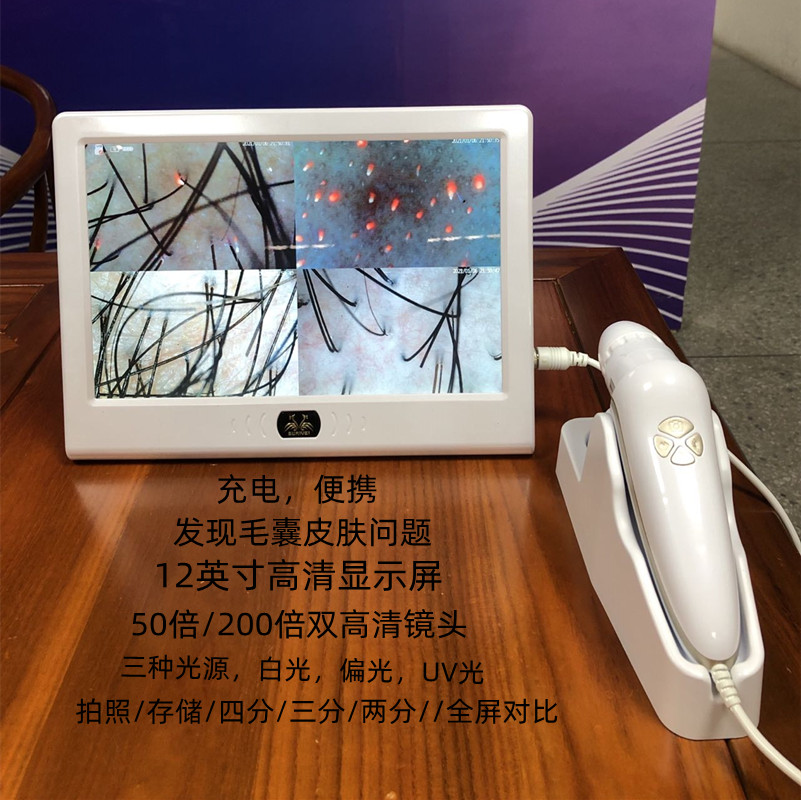 The scalp fur detector 200 times HD three spectral detection dual lens charging portable storage photo comparison