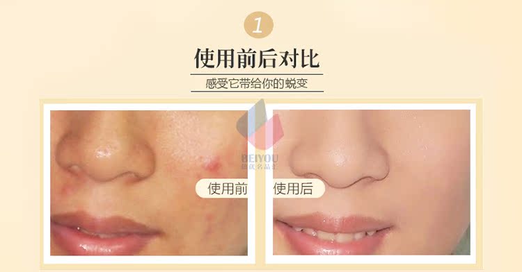 Thai Mistine 24 giờ dạng bột lỏng Mật ong nhẹ và thoáng khí Lâu trôi không che khuyết điểm Trang điểm kiểm soát dầu không thấm nước - Quyền lực phấn phủ make up forever