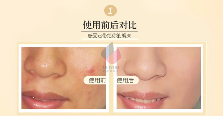 Thai Mistine 24 giờ dạng bột lỏng Mật ong nhẹ và thoáng khí Lâu trôi không che khuyết điểm Trang điểm kiểm soát dầu không thấm nước - Quyền lực phấn phủ clio