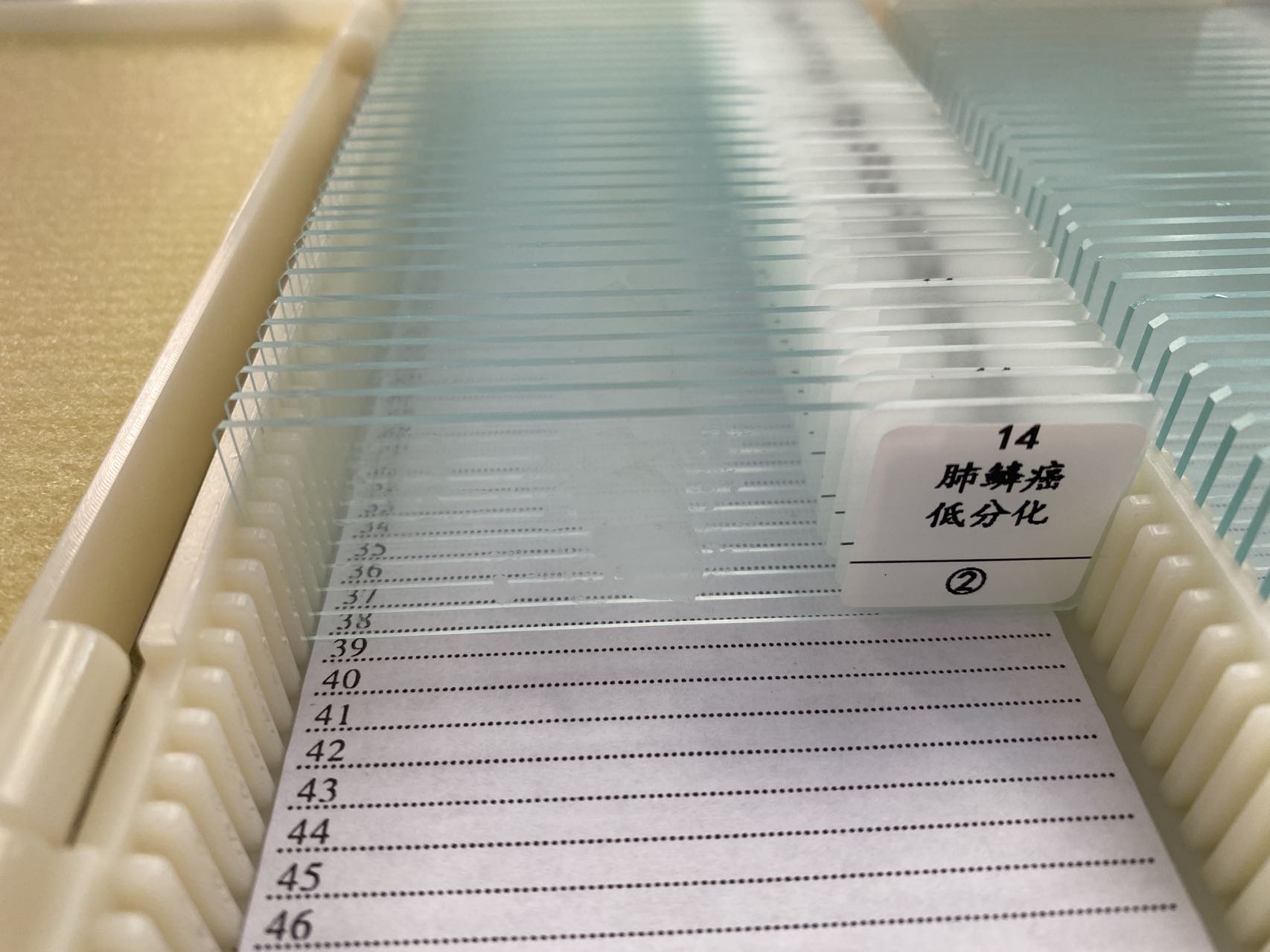 免疫组化生物显微镜科研病理组织白片医院实验研究生课题抗原修复