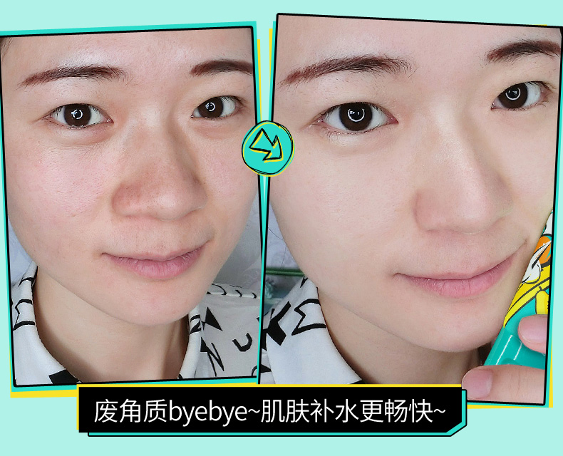 Shu Youge Papaya Tẩy tế bào chết Bàn tay và Cơ thể chân Tẩy tế bào chết mụn đầu đen tẩy tế bào chết sâu cho nam và nữ tẩy tế bào chết cho da hỗn hợp