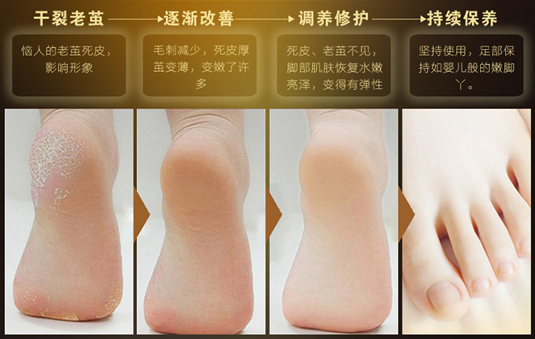 Kem dưỡng da tẩy tế bào chết cho da chân vàng 24K tẩy tế bào chết mềm mịn chân chống khô chân thuốc trị nẻ gót chân