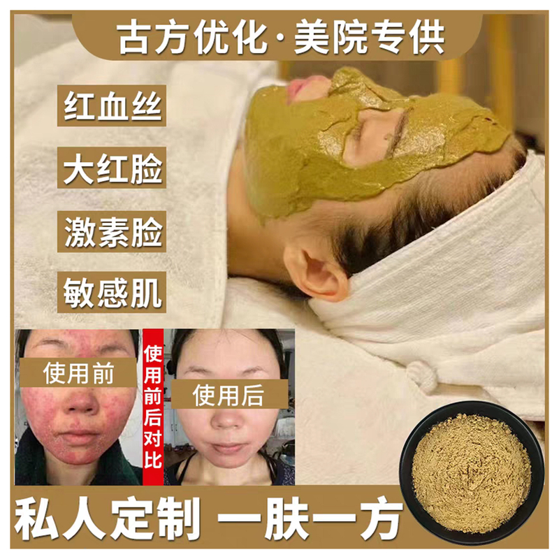 Chinese Herbal Soothing and Conditioning Rose Acne Sensitive Skin Hormone Damaged Face Red Face Beauty Salon Conditioning Mask Powder Chinese Herbal Soothing and Conditioning Rose Acne Sensitive Skin Hormone Damaged Face Red Face Beauty Salon Conditioning Mask Powder