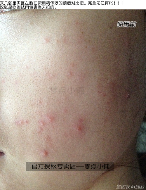 [15年5月产 宝拉珍选2%BHA水杨酸精华液118