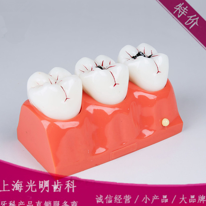 牙科材料 齿科材料 口腔材料牙科用品     牙科模型