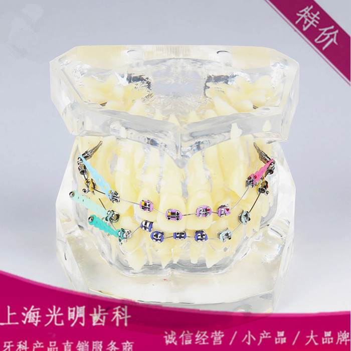 修复模型 牙科材料