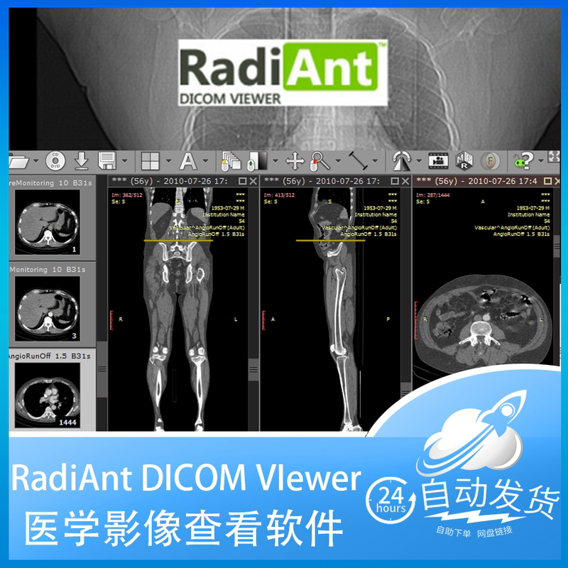 Radiant Dicom Viewer 2025 Chinese Dcm Medical Ct Image Viewing Tool Permanent Version