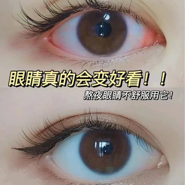SMEK Eye Drops ສານສະກັດຈາກສະໝຸນໄພບຳລຸງສາຍຕາ ເຢັນສະບາຍ, ອ່ອນໂຍນ ແລະ ຊຸ່ມຊື່ນ ພ້ອມຈັດສົ່ງຟຣີ ສັ່ງຊື້ 3 ໂຕຂື້ນໄປ