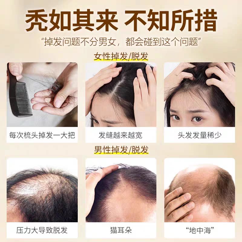 香港传承古方何首乌生姜侧柏叶洗发水真能防脱生发吗?2025年新规全解析_头发护理_淘宝美妆网