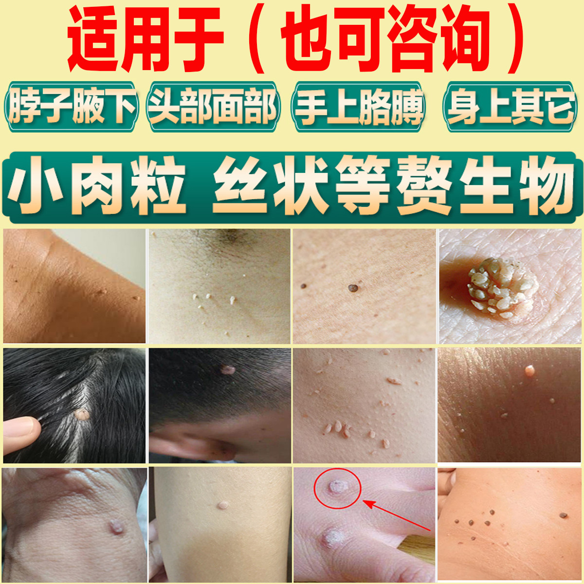去脖子上扁平小肉粒皮赘丝状疣专用药膏推荐｜腋下祛疙瘩神器2025实测有效-浴足剂-淘宝好物网