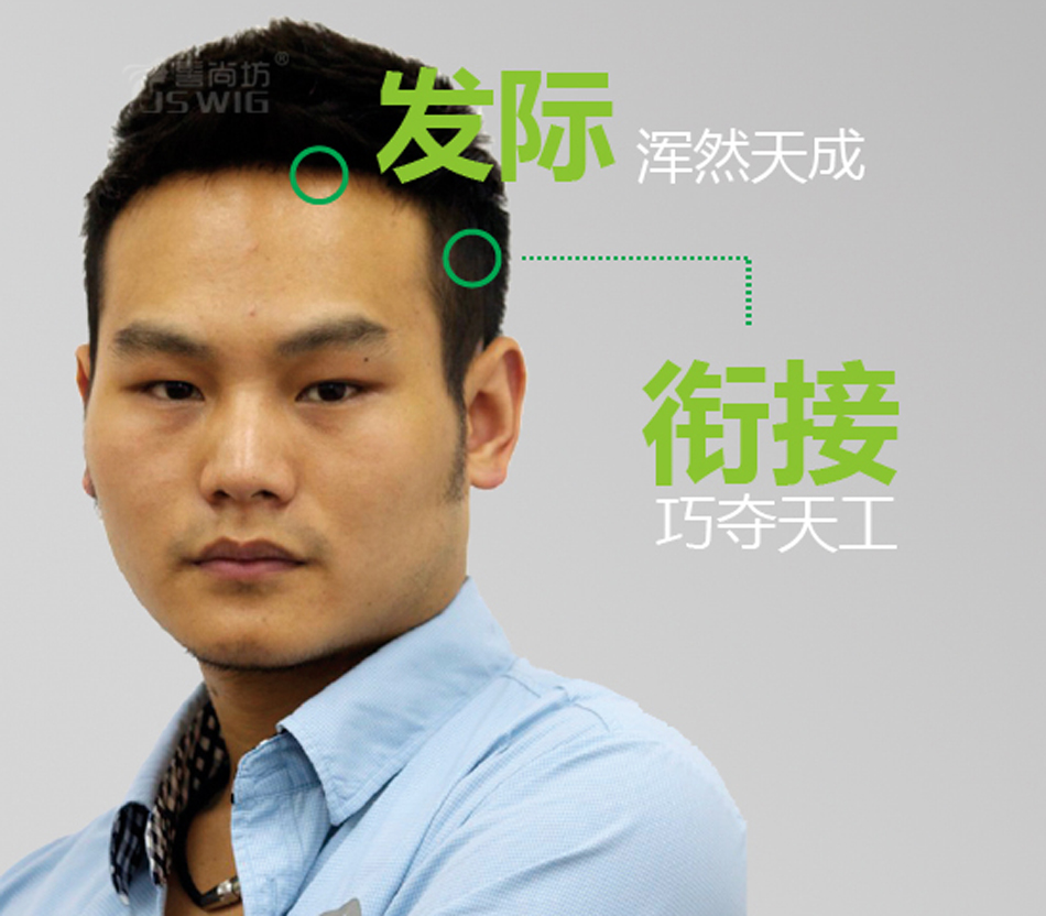 Men hair loss hair - hair - hair - hair - hair - hair - hair - hair - hair - hair - hair - hair - hair - hair - hair - hair - hair - hair - hair - hair - hair - hair - hair - hair - hair - hair - hair - hair - hair - hair - hair - hair - hair - hair - hair - hair - hair - hair - hair - hair - hair - hair - hair