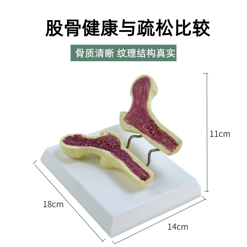 人体骨骼骨质疏松解剖模型腿骨解剖面 脊柱切面标本 病变腰椎模型