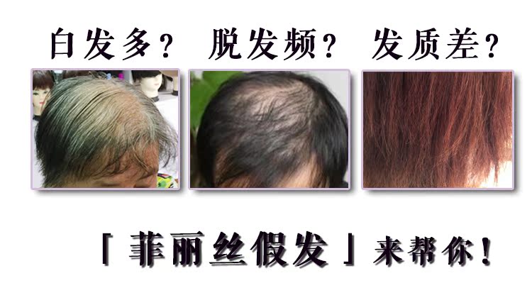 Extension cheveux - Ref 218580 Image 10