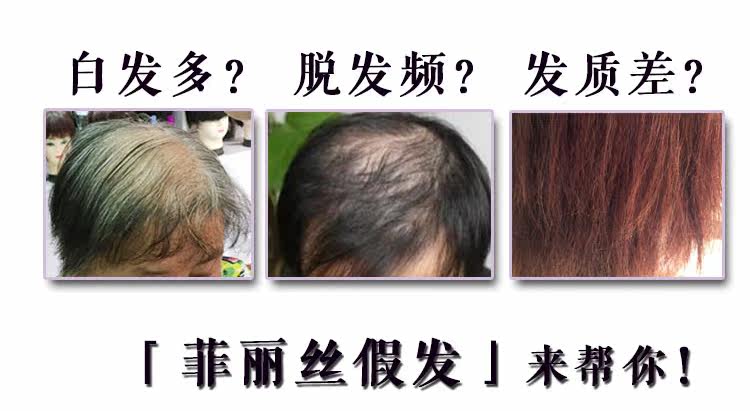 Extension mèches - Ref 218655 Image 10