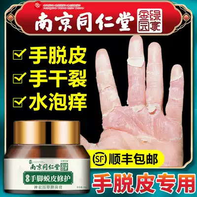 Hand peeling repair cream Seasonal finger cracking Palm hand molting burst skin Hand chapped hand peeling dry