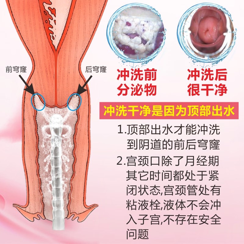 Home Vaginal Lynching Cleaner Gynecologic Flushing Cleaner Private cleaner Clean sanitary Female washers Inner Yin Domestic