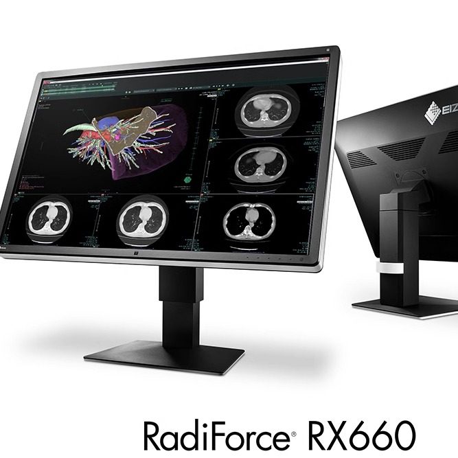 艺卓EIZO RadiForce RX660 6MP 30英寸医疗用液晶显示器 CT，MRI：医疗影像诊断新标杆 -企业级显示器-淘宝好物网