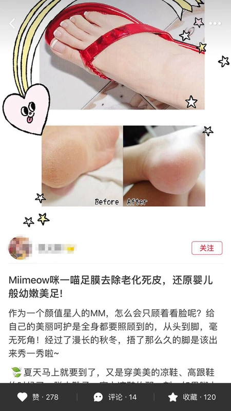 Nhật MiiMeow Mi A 喵 角 角 chân chăm sóc bàn chân để da chết 茧 dưỡng ẩm mặt nạ chân