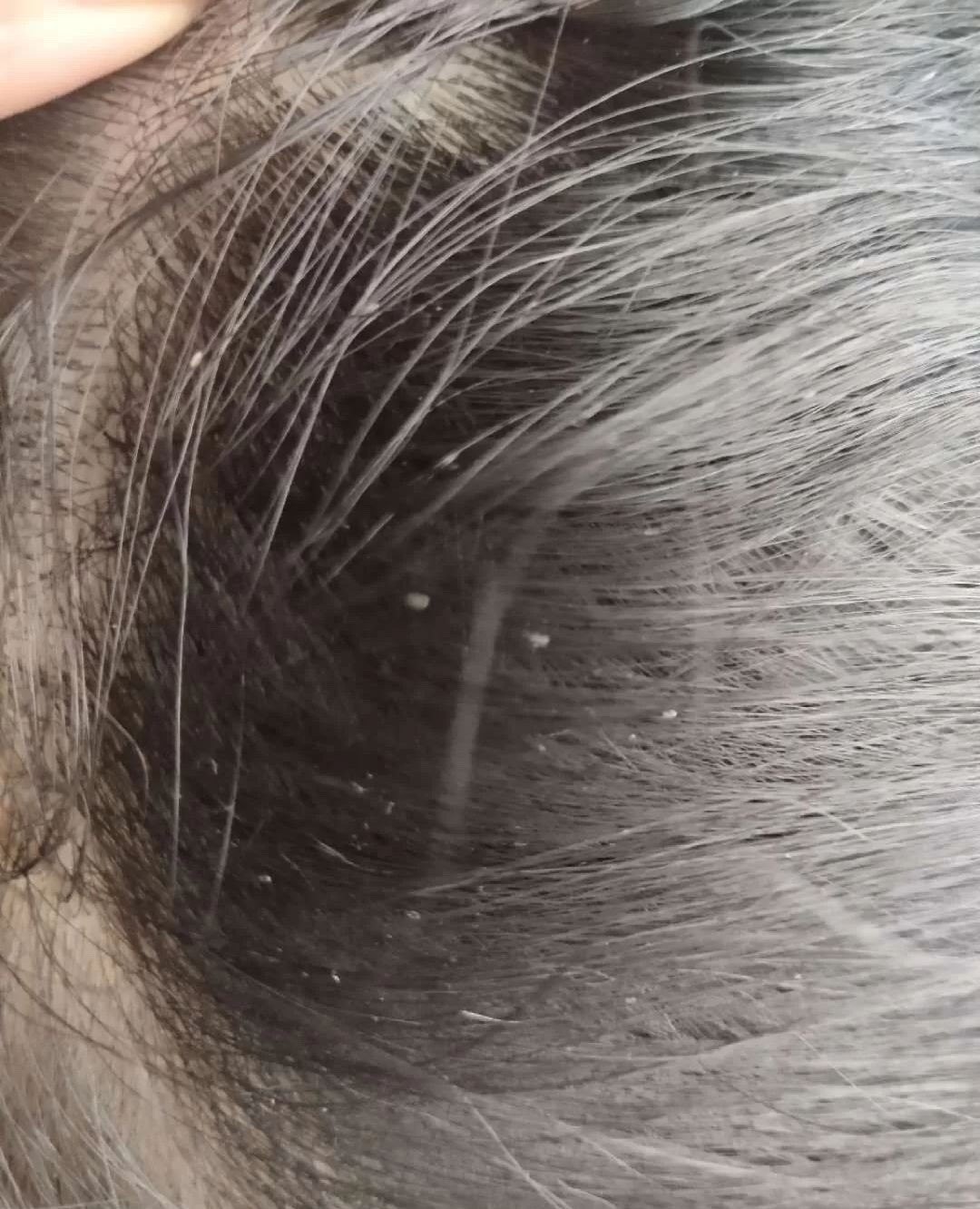 虱子药小女孩头发虱立净非去除头虱儿童虱子的药洗发水虱卵百部酊评价- 淘宝网, image size:1080x1332