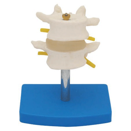 正常腰椎模型（二节），人体腰椎模型