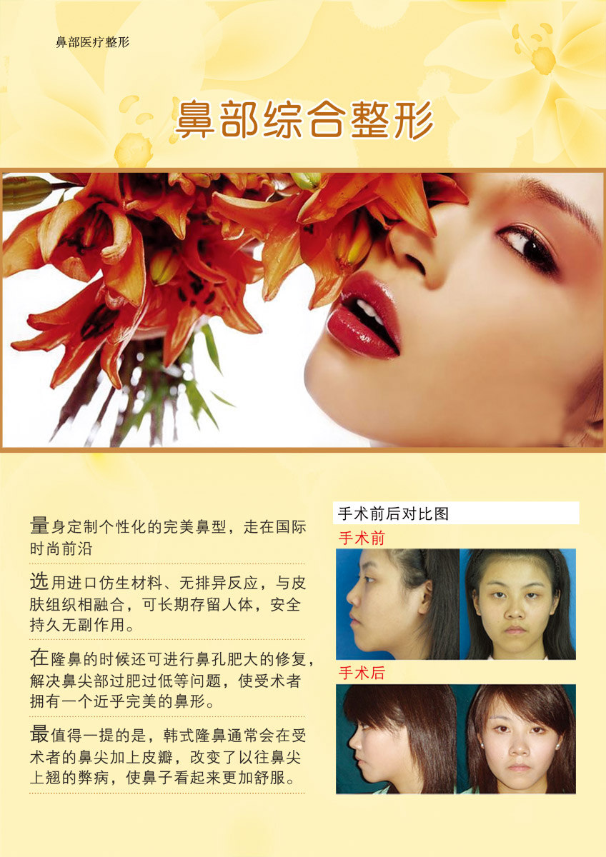 海报印制96素材鼻展板32鼻部整形