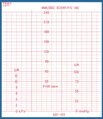 ASF-020 tire monitoring paper old Anke tire monitoring Paper 116*100-150