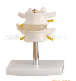 正常腰椎组合 （二节）/脊椎模型骨骼模型脊椎模型腰椎模型XC-116