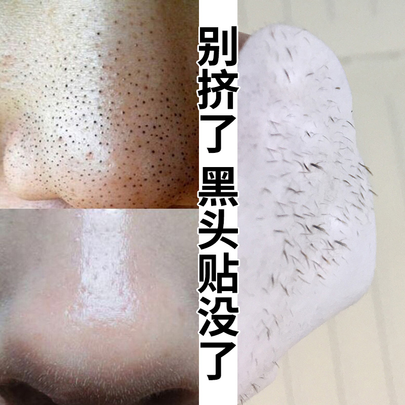 海洋诗韵去黑头收缩毛孔套装祛黑头导出液鼻贴粉刺撕拉式男女学生