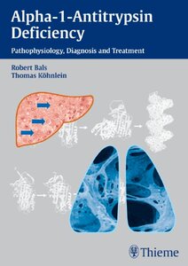 【预售】Alpha-1-Antitrypsin Deficiency: Pathophysiolog...