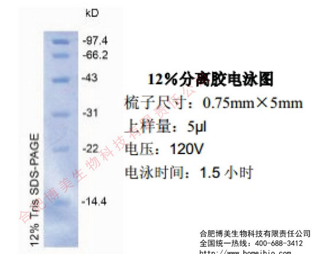低分子量蛋白 Marker I（14.4KD－97.4KD）含票20T