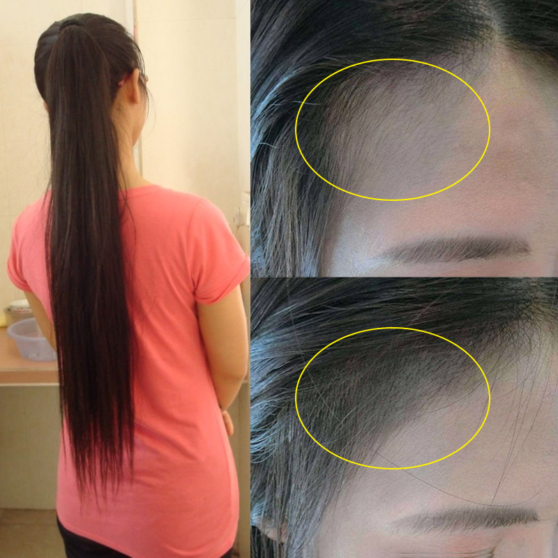 正品生姜洗发水防脱发生发增发密发男女老姜王姜汁头发增长液