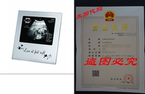 Prinz 5 by 4-Inch Love at First Sight Sonogram Frame