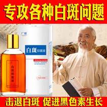 Vitiligo topical cream covering cream melanin nemesis white spot net waterproof skin color Baidian crazy topical Guangya white