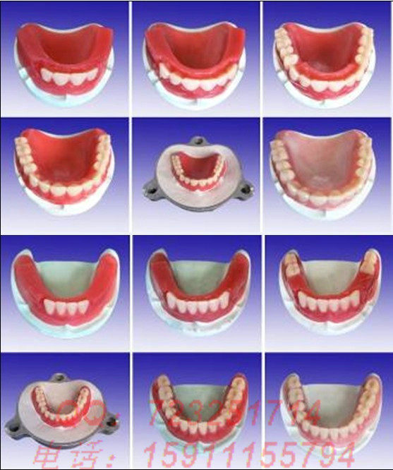 Steps for making full mouth teeth