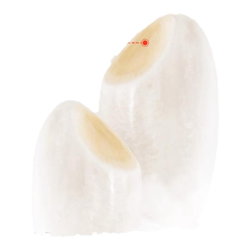 ڲ1̦ѿױ43g(4.3x10 ͯʳѿСԲױްɰִױʳ10.4Ԫ