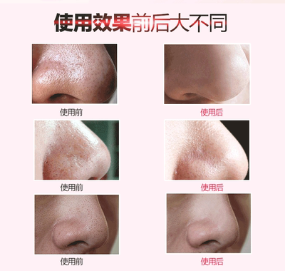 电动面部洁面仪