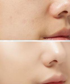 悠雅裸妆气垫BB美颜遮瑕控油怎么样有用吗，母女俩使用一个月效果对比,第10张