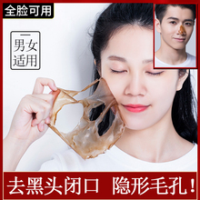 去98%面部毛孔垃圾 去脏面男女通用 无效不要钱 买1送5