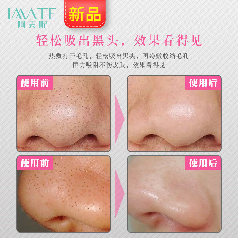 imate�綯����ͷ����M-3301